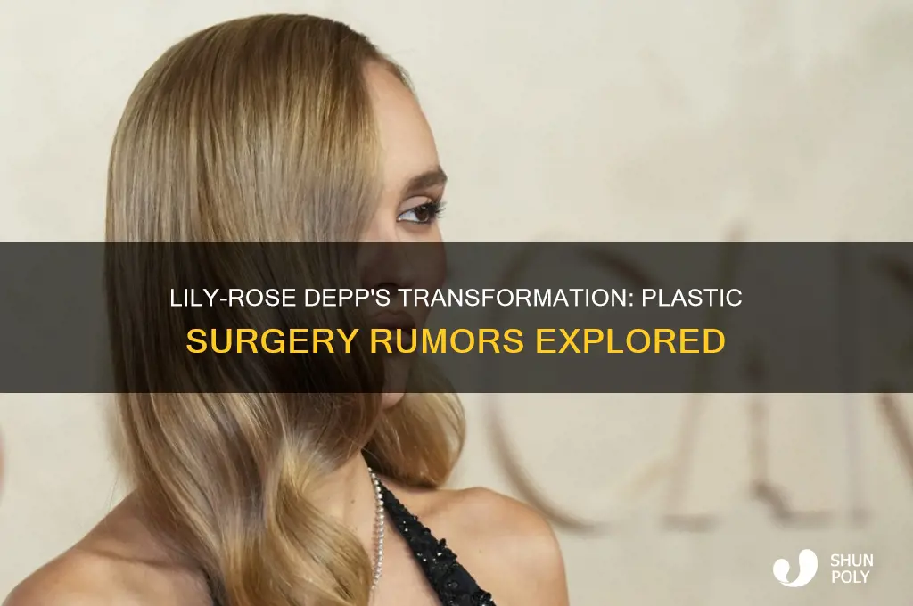 did lily rose depp get plastic surgery