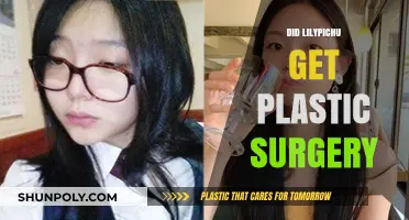 Lilypichu Plastic Surgery Rumors: Fact or Fiction?