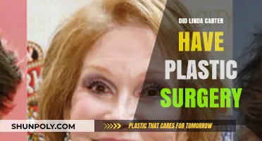 Linda Carter's Transformation: Plastic Surgery Rumors Explored and Debunked
