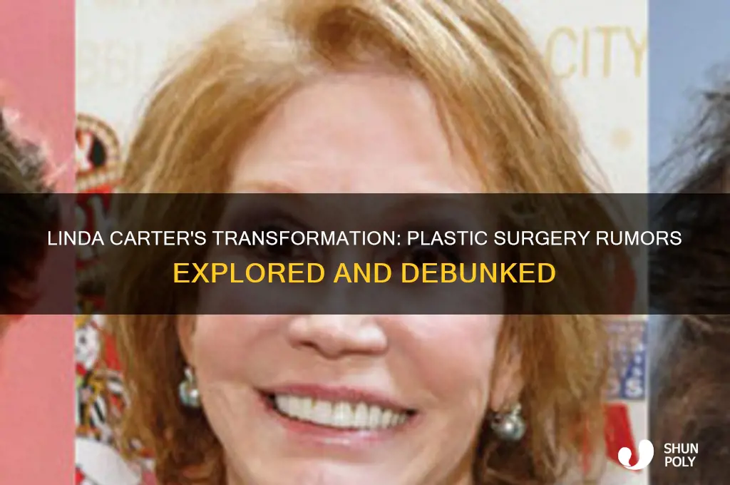 did linda carter have plastic surgery