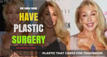 Linda Evans Plastic Surgery: Fact-Checking the Actress' Transformation Rumors
