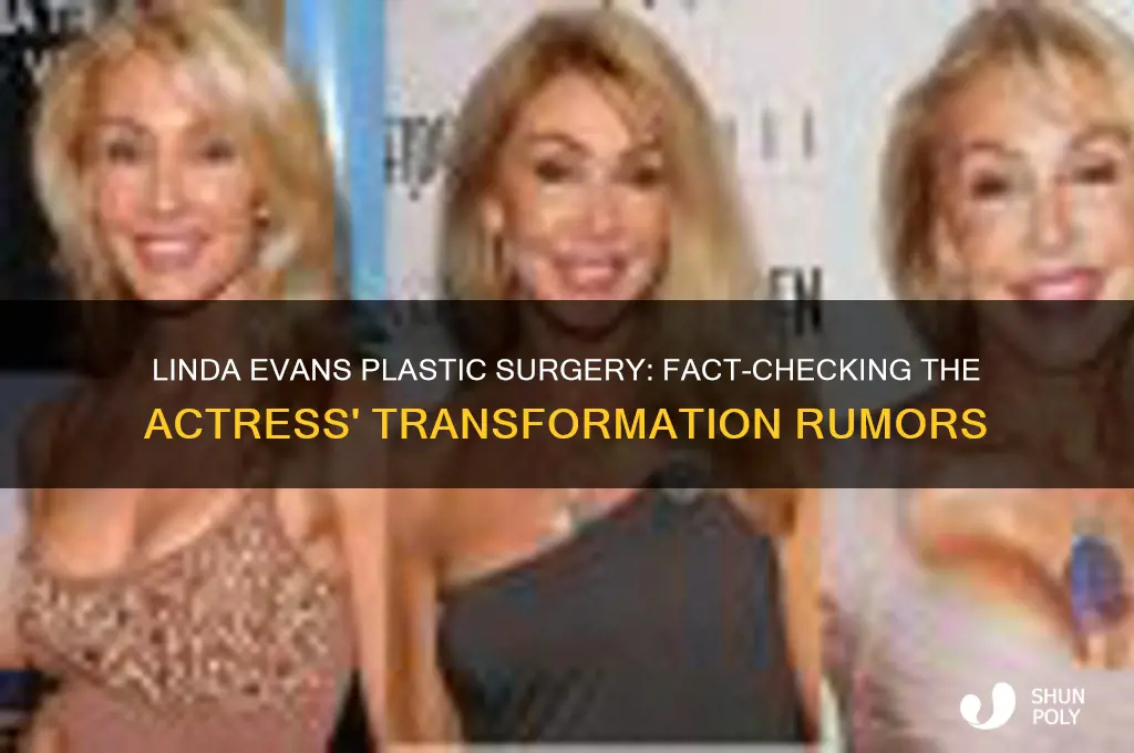 did linda evans have plastic surgery