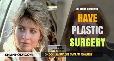Linda Kozlowski's Transformation: Plastic Surgery Speculations and Truths