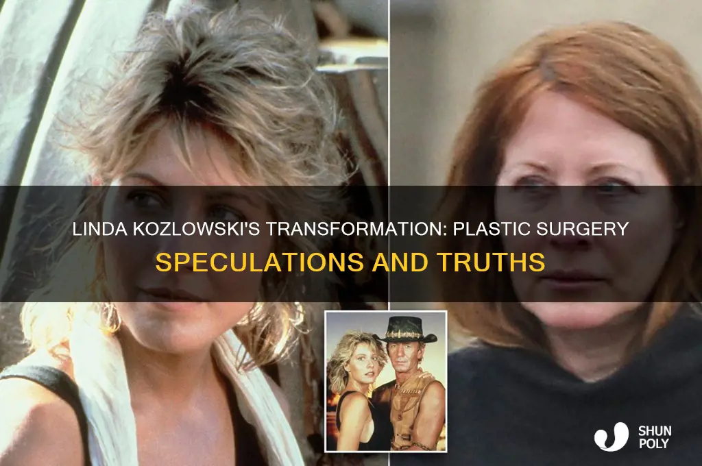 did linda kozlowski have plastic surgery