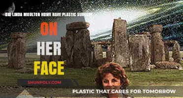 Linda Moulton Howe's Face: Plastic Surgery Speculations Explored