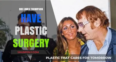 Linda Thompson's Transformation: Plastic Surgery Speculations and Truths Revealed