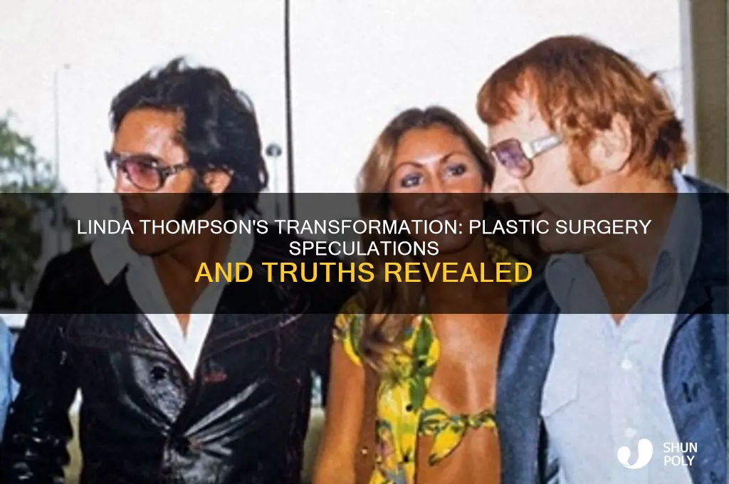 did linda thompson have plastic surgery