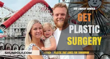 Lindsay Arnold's Transformation: Plastic Surgery Speculations and Truths