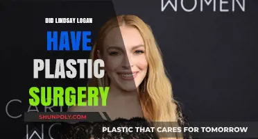 Lindsay Logan's Transformation: Plastic Surgery Speculations and Truths