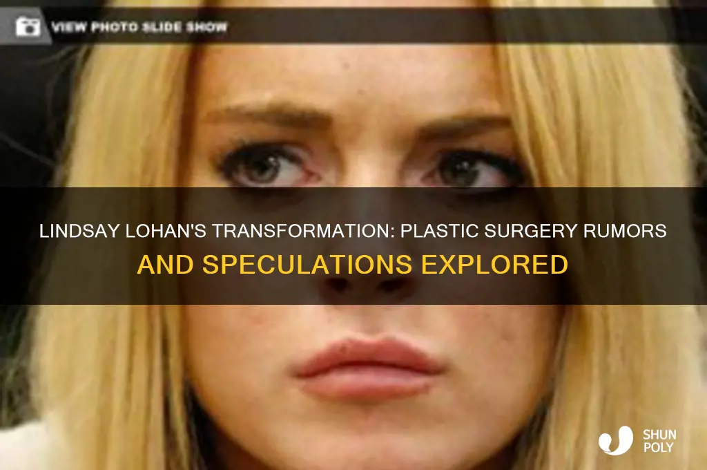did lindsay lohan get plastic surgery
