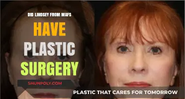 Lindsey MAFS Plastic Surgery: Fact-Checking Her Transformation Rumors
