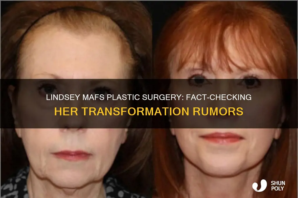 did lindsey from mafs have plastic surgery