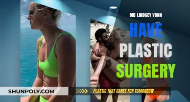 Lindsey Vonn Plastic Surgery: Fact-Checking Rumors and Speculations