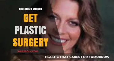 Lindsey Wagner's Transformation: Plastic Surgery Speculations and Truths