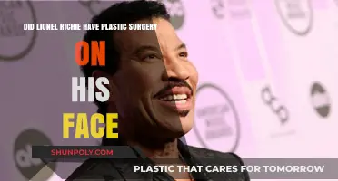 Lionel Richie's Face: Plastic Surgery Rumors Explored and Debunked
