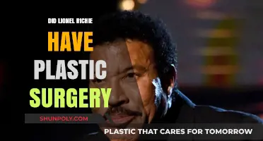 Lionel Richie's Transformation: Plastic Surgery Speculations and Truths