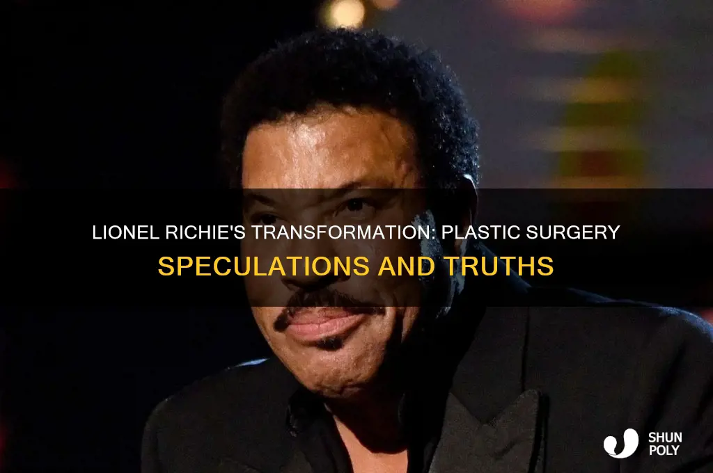 did lionel richie have plastic surgery