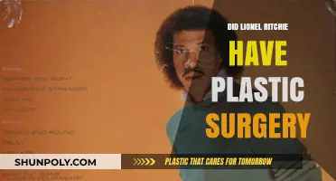 Lionel Richie's Transformation: Plastic Surgery Speculations and Truths