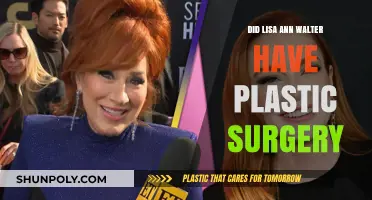 Lisa Ann Walter Plastic Surgery: Fact-Checking the Transformation Rumors