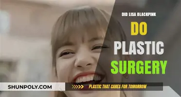 Lisa Blackpink Plastic Surgery: Fact-Checking the Rumors and Speculations
