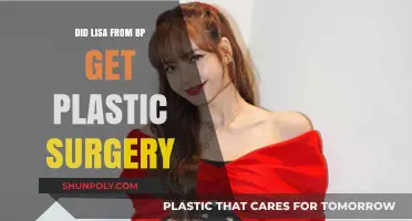 Did Lisa from Blackpink Undergo Plastic Surgery? Unveiling the Truth