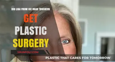 Lisa Kelly's Transformation: Plastic Surgery Rumors on Ice Road Truckers