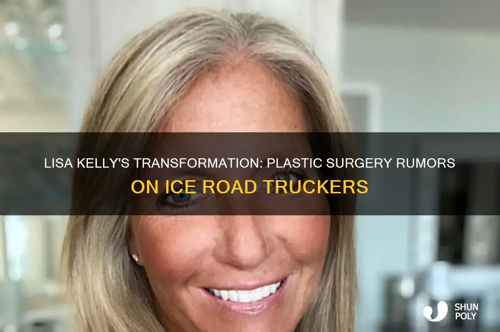 did lisa from ice road truckers get plastic surgery