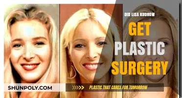 Lisa Kudrow's Transformation: Plastic Surgery Rumors Explored and Debunked