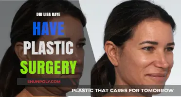 LisaRaye Plastic Surgery: Fact-Checking Her Transformation and Rumors