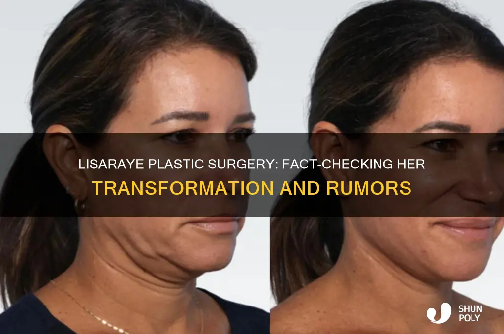 did lisa raye have plastic surgery