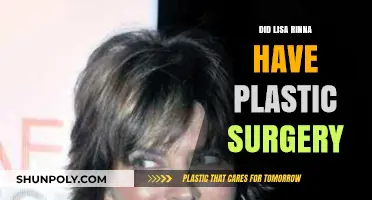 Lisa Rinna's Transformation: Plastic Surgery Speculations and Truths Revealed