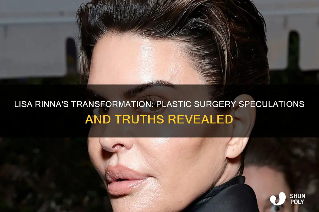 did lisa rinna have plastic surgery