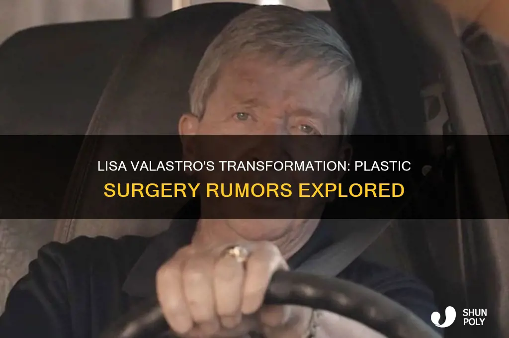 did lisa valastro get plastic surgery