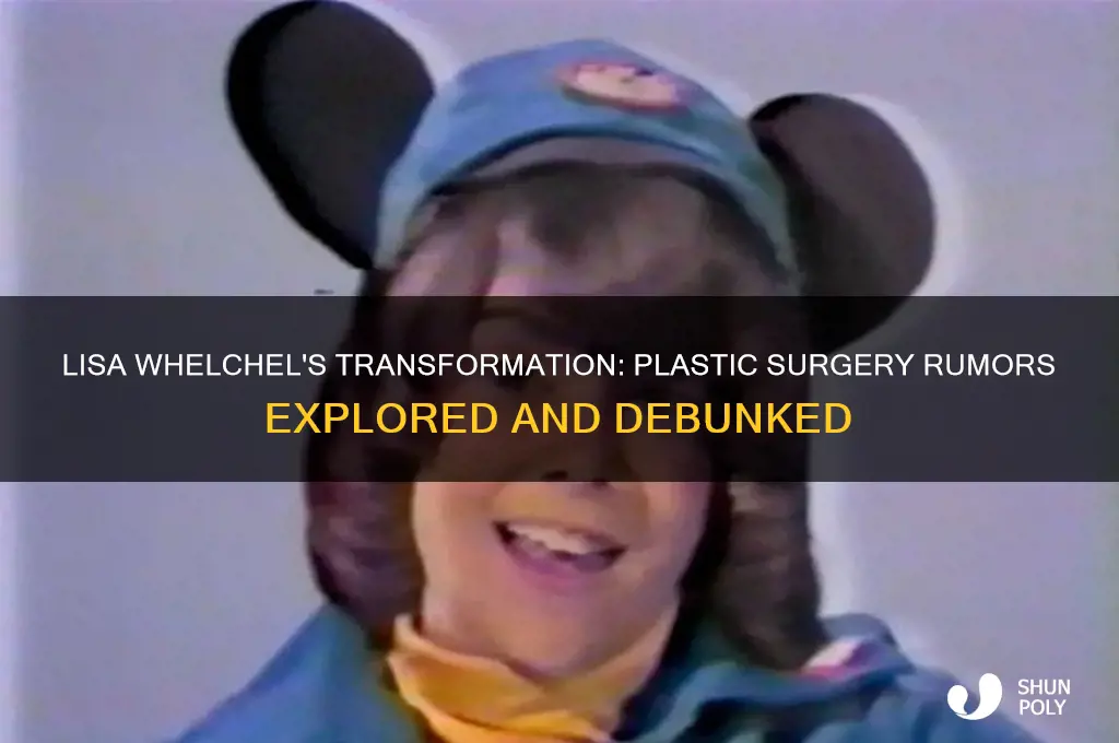 did lisa whelchel have plastic surgery