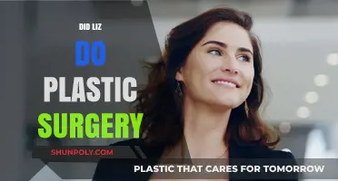 Did Liz Undergo Plastic Surgery? Uncovering the Truth Behind Her Look