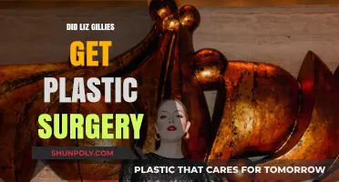 Liz Gillies Plastic Surgery: Fact-Checking the Transformation Rumors