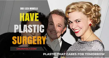 Liza Minnelli's Transformation: Plastic Surgery Speculations and Truths Revealed