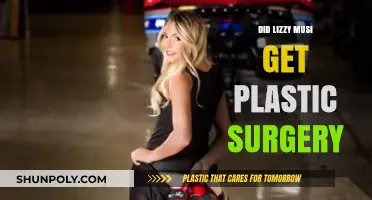 Did Lizzy Musi Undergo Plastic Surgery? Unveiling the Truth