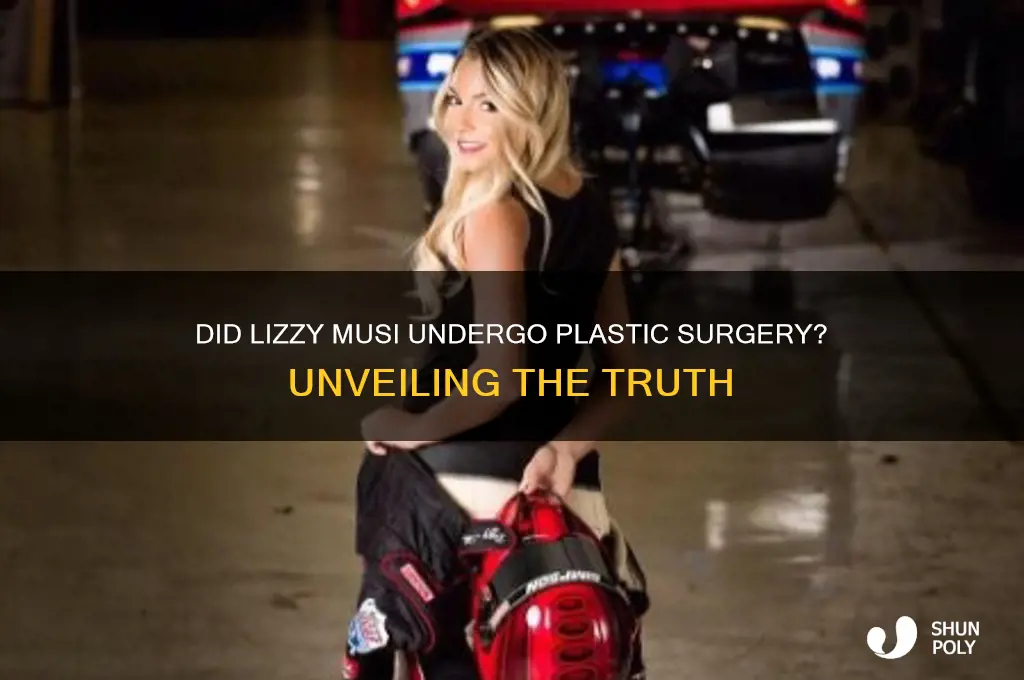 did lizzy musi get plastic surgery