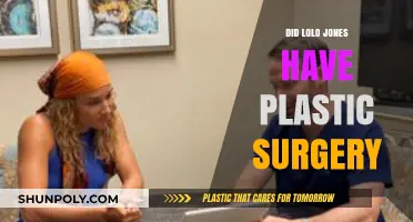 Lolo Jones Plastic Surgery: Fact-Checking the Rumors and Speculations