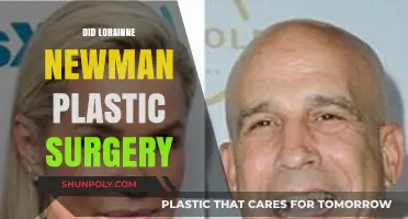 Lorraine Newman's Plastic Surgery: Fact-Checking the Rumors and Speculations