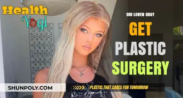 Loren Gray's Transformation: Plastic Surgery Rumors Explored and Debunked