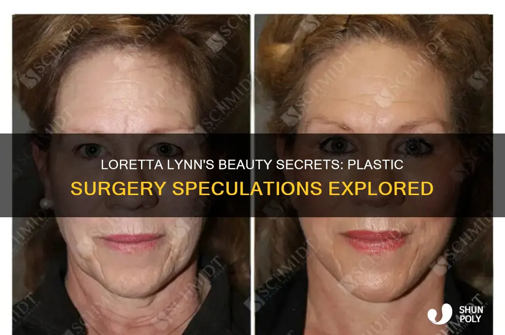 did loretta lynn ever have plastic surgery