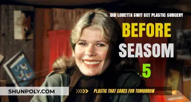 Loretta Swit's Transformation: Plastic Surgery Before Season 5?