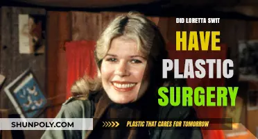 Loretta Swit's Transformation: Plastic Surgery Rumors Explored and Debunked