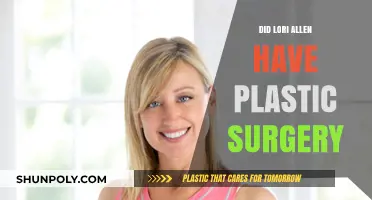 Lori Allen's Transformation: Plastic Surgery Speculations and Truths Revealed