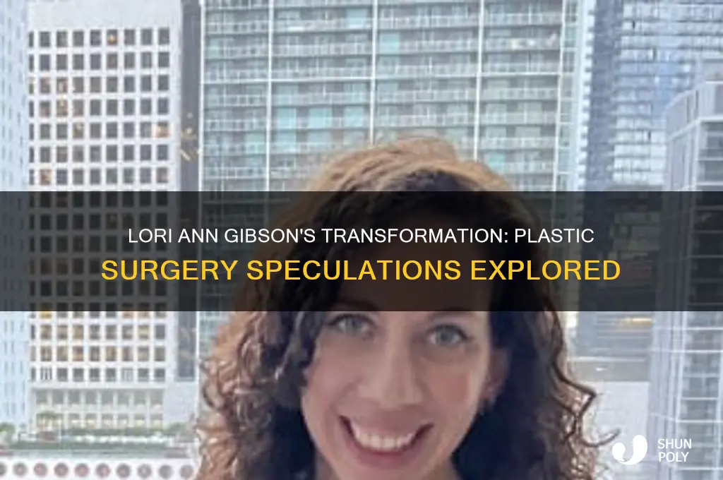 did lori ann gibson have plastic surgery