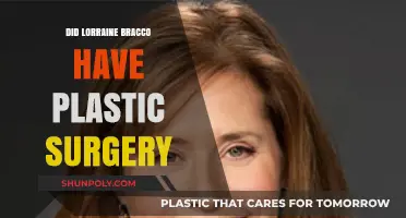 Lorraine Bracco's Transformation: Plastic Surgery Speculations and Truths Revealed
