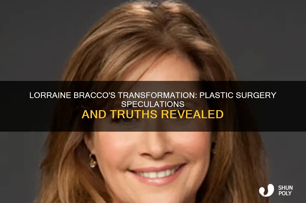 did lorraine bracco have plastic surgery