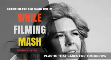 Loretta Swit's MASH Transformation: Plastic Surgery Speculation Explored
